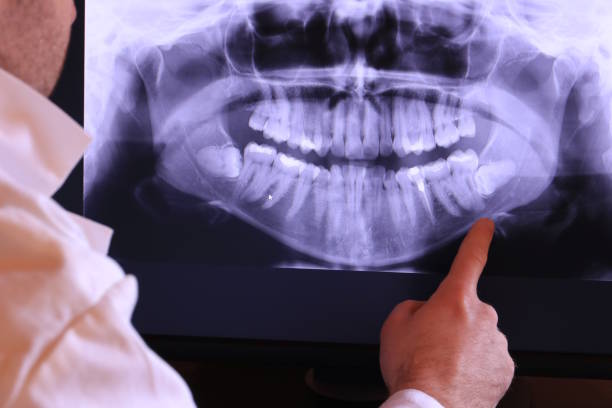 Best Broken or Cracked Tooth Emergency Dentist in Rittman, OH