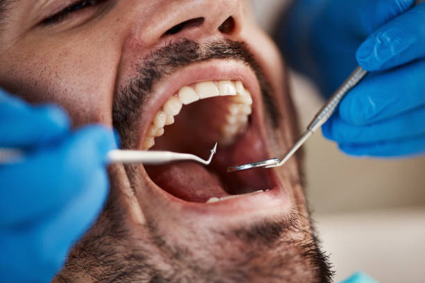 Best Pediatric Emergency Dentist in Rittman, OH